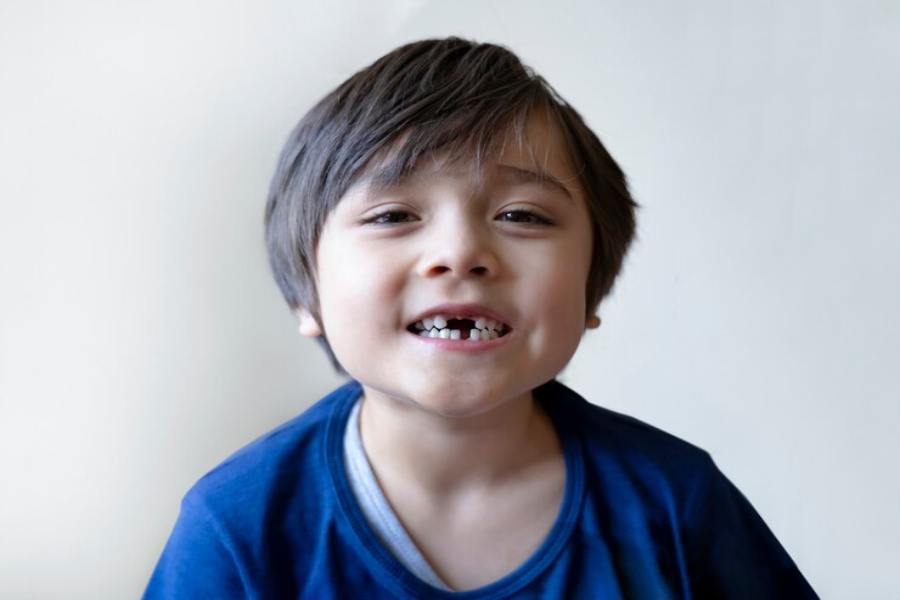 What Age Do Kids Lose Their Front Teeth
