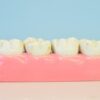 Why Are Kids Teeth Yellow