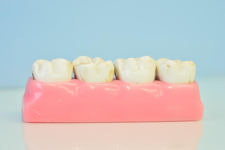 Why Are Kids Teeth Yellow
