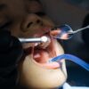 How to Pull a Kid's Tooth