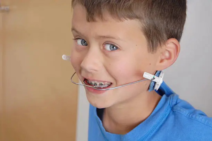 How to Get Kid Used to Palate Expander